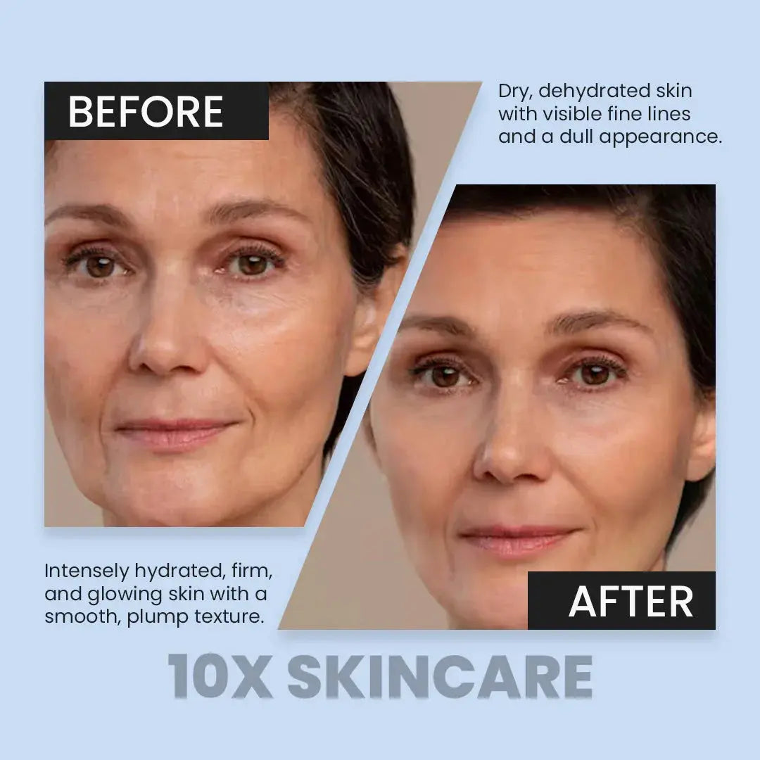 Hydroboost Serum by 10X Skincare Hyaluronic Acid Hydration Serum for Glowing, Plump & Dewy Skin (30ml) 10X Skin Care